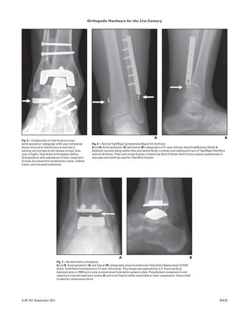 New and Improved Orthopedic Hardware for the 21st Century: Part 2 ...