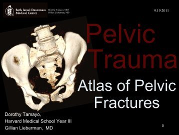 Atlas of Pelvic Fractures