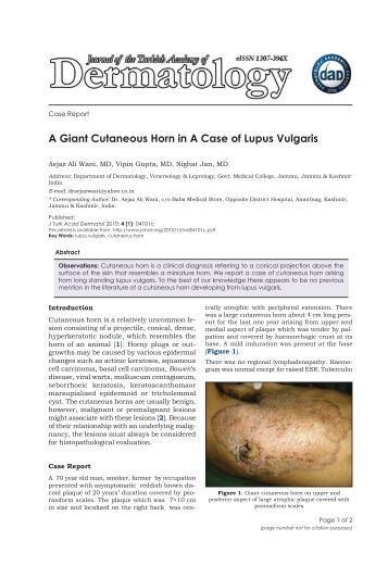 Giant keratoacanthoma-like cutaneous horn of the upper leg 