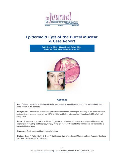 Epidermoid Cyst of the Buccal Mucosa: A Case Report