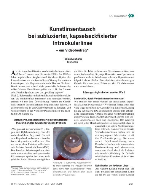 Kunstlinsentausch Bei Subluxierter Kapselsackfixierter Intraokularlinse