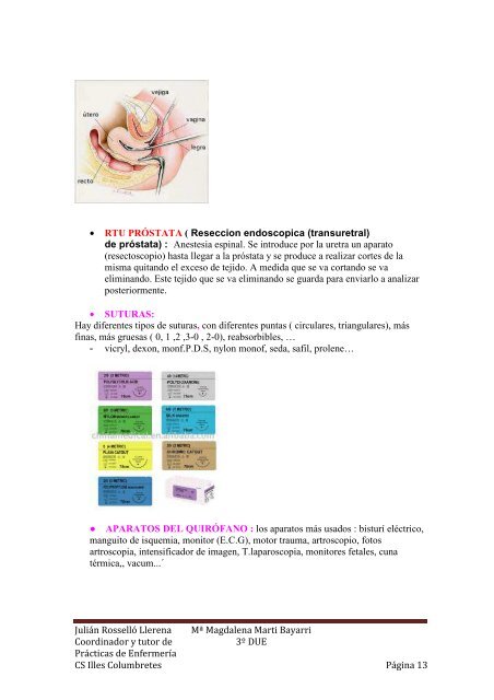 inflamación de la próstata que hace nylon