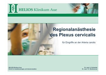 Regionalanästhesie des Plexus cervicalis - HELIOS Kliniken GmbH
