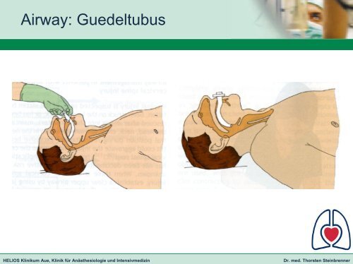 ERC Guidelines for Resuscitation 2005 - HELIOS Kliniken GmbH