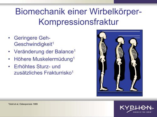 Osteoporose - Herz-Jesu-Krankenhaus Fulda