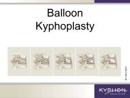 Balloon Kyphoplasty - Herz-Jesu-Krankenhaus Fulda