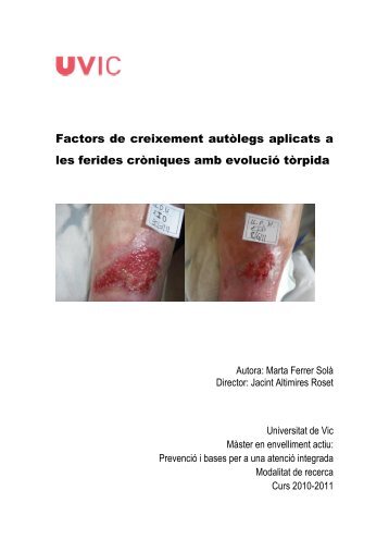 Factors de creixement autòlegs aplicats a les ferides ... - Recercat