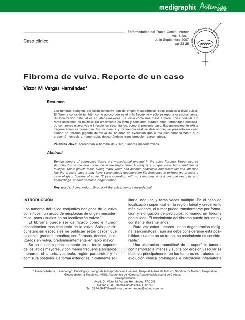 Fibroma de vulva. Reporte de un caso - edigraphic.com