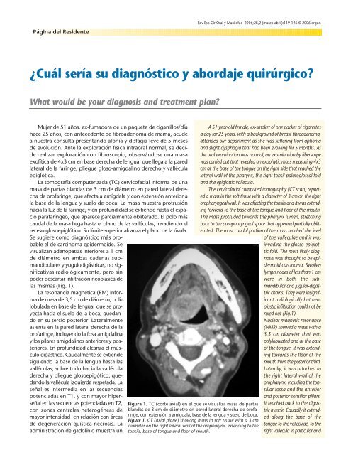 ¿Cuál sería su diagnóstico y abordaje quirúrgico? - SciELO España