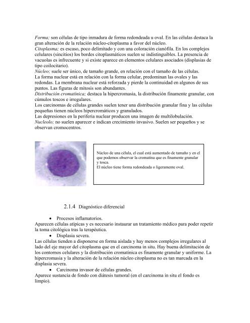 El cáncer de pulmón - La web del califa