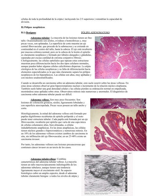 El cáncer de pulmón - La web del califa