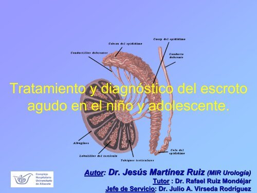 Tratamiento y diagnóstico del escroto agudo en el