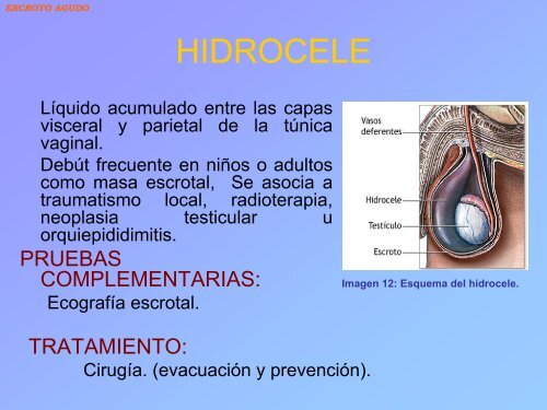 Tratamiento y diagnóstico del escroto agudo en el