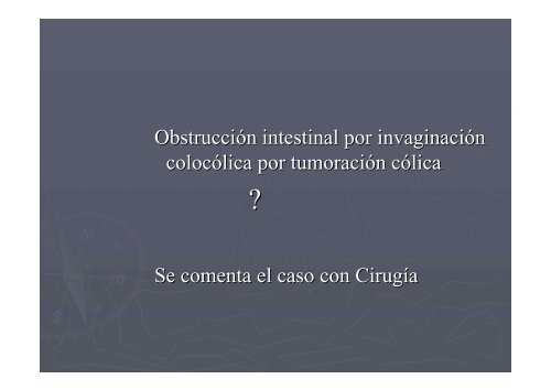 Causa infrecuente de dolor abdominal y náuseas - Sociedad ...