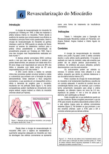 Apostila_files/Capitulo 6 _REVASC.pdf