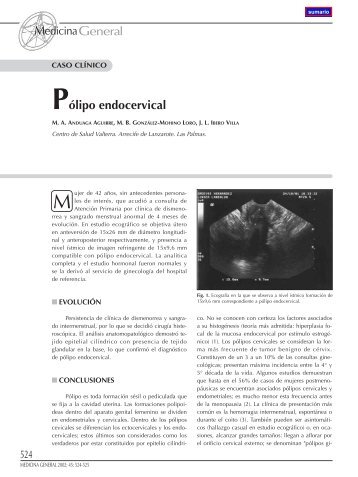 524 Pólipo endocervical