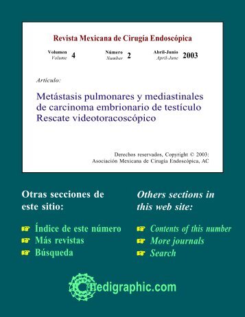 Metástasis pulmonares y mediastinales de carcinoma embrionario ...