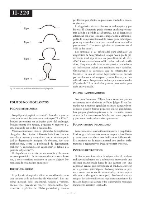 Tumores benignos del estómago. - Sociedad Argentina de Cirugía ...