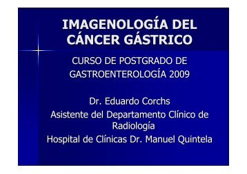 imagenología del cáncer gástrico - Clínica de Gastroenterología ...
