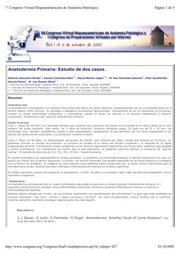 Anetodermia Primaria: Estudio de dos casos. - Comunidad Virtual ...