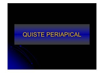 QUISTES PERIAPICALES