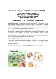 Resonancia Magnética compatible con Esclerosis Múltiple
