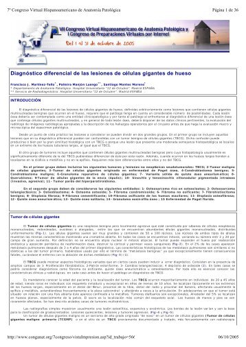 Diagnóstico diferencial de las lesiones de células gigantes de hueso