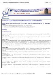 Carcinoma Epidermoide sobre Acrodermatitis Crónica Atrófica