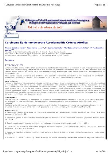 Carcinoma Epidermoide sobre Acrodermatitis Crónica Atrófica