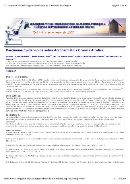 Carcinoma Epidermoide sobre Acrodermatitis Crónica Atrófica