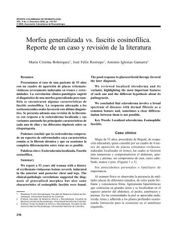 Morfea generalizada vs. fascitis eosinofílica. Reporte de un caso y ...