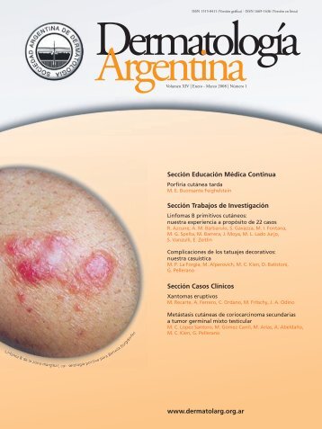 Dermatologia revista 20080328:Dermatologia revista 20070307.qxd ...