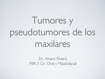 Dr. Alvaro Rivero MIR-3 Cir. Oral y Maxilofacial - 12 de Octubre