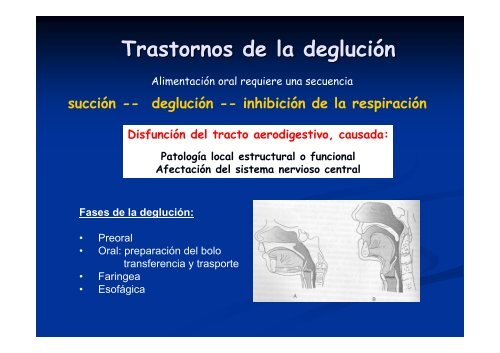 Síndrome aspirativo crónico