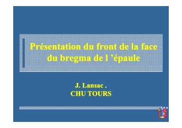 Présentation du front