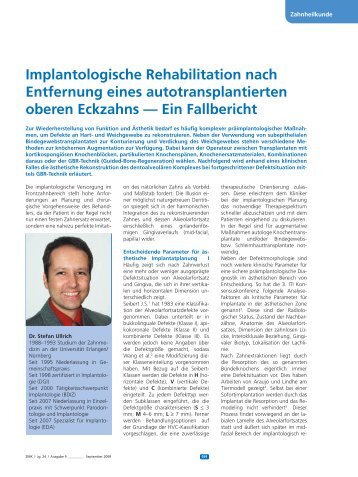 Implantologische Rehabilitation nach Entfernung ... - Dr. Stefan Ullrich