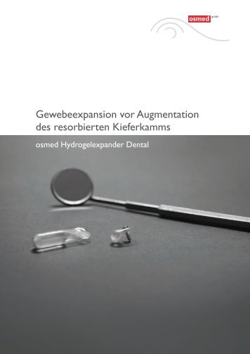 Gewebeexpansion vor Augmentation des ... - osmed gmbh