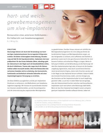 zum Fallbericht - DENTSPLY Friadent