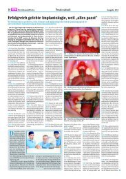 DZW Implantatplanung