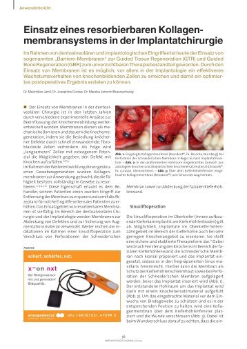 Artikel downloaden - Die Dentalbox - Resorba