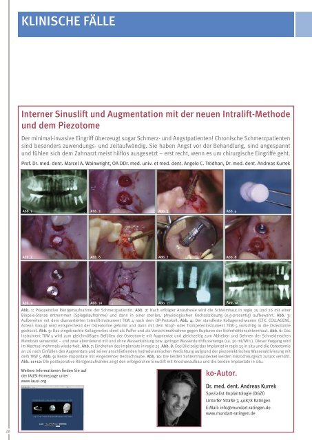 Kompetenz in Chirurgie und Implantologie - implantologie-whv.de