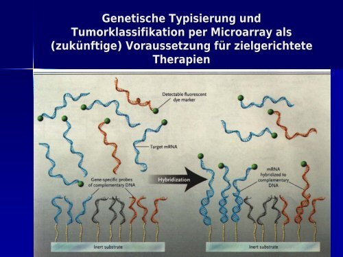 Stammzellkonzept und zielgerichtete Therapien bei Brustkrebs