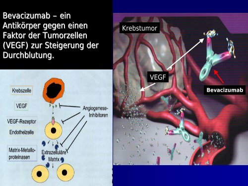 Stammzellkonzept und zielgerichtete Therapien bei Brustkrebs