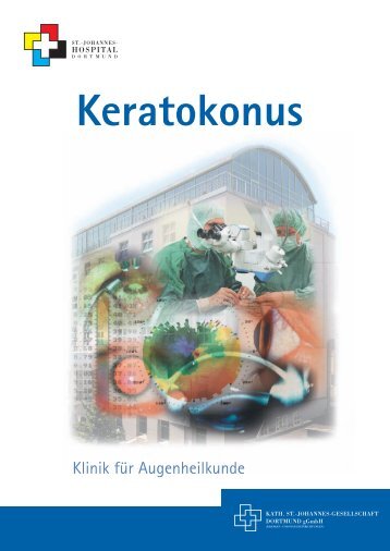 Keratokonus - St.-Johannes-Hospital