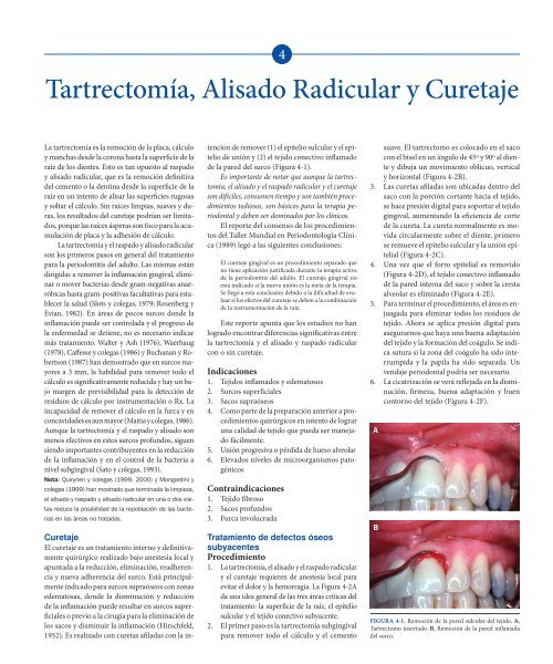 Tartrectomía, Alisado Radicular y Curetaje - Axon