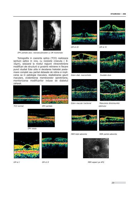 Interior 1_2006.qxd - Oftalmologia.ro