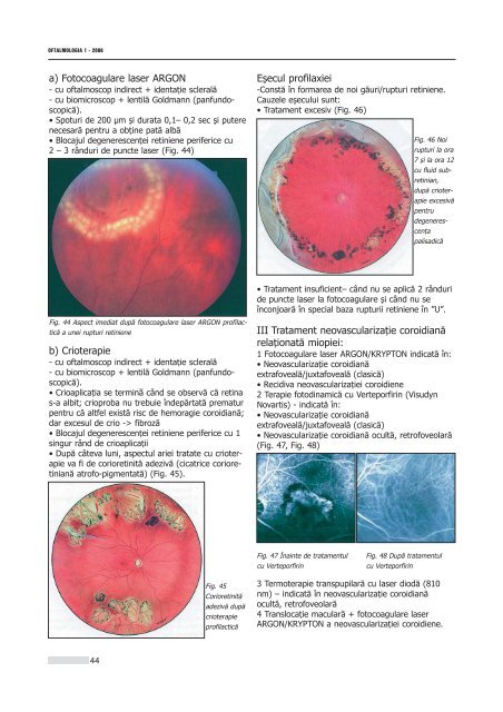 Interior 1_2006.qxd - Oftalmologia.ro