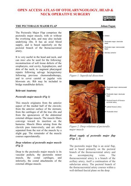 Pectoralis major flap - Vula - University of Cape Town