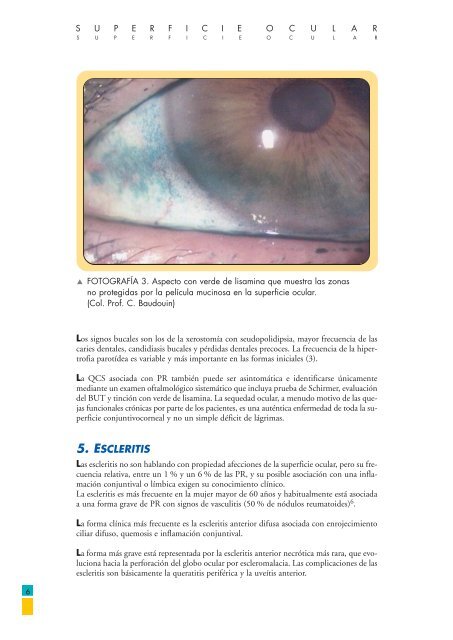 Evela Una Prueba De Schir Evela Una Prueba De Schir