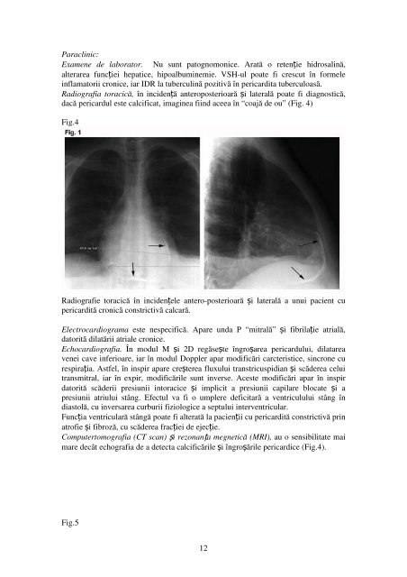 Cap.IX Pericarditele - Cardiologie.ro